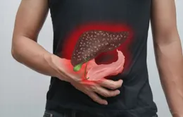 6 triệu chứng ung thư gan ai cũng cần phải biết