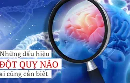 Dấu hiệu và cách phòng ngừa tai biến mạch máu não