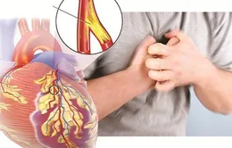 Cẩn trọng cơn đau ngực cấp tính báo động bệnh mạch vành nguy hiểm