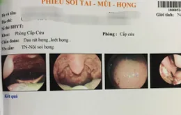 Viêm loét miệng, lưỡi sau khi đi phun thuốc diệt cỏ
