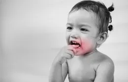 Tai sao lại bị đau khi mọc răng?