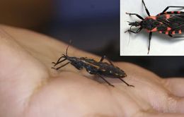 Mỹ: Cảnh báo căn bệnh chết người mang tên “Chagas”