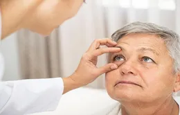 Mỹ: Khám mắt có thể phát hiện triệu chứng bệnh Alzheimer