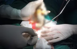 Vòi xịt nước dài 45cm mắc kẹt trong hậu môn nam thanh niên