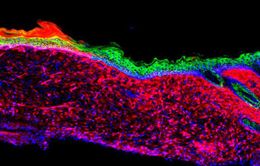 Đột phá công nghệ tế bào giúp chữa lành vết loét da lớn