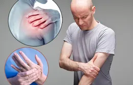 Những điều mà cơ bắp đang cố gắng nói với bạn
