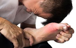 Những nguyên tắc giúp bạn sống hòa bình với gout