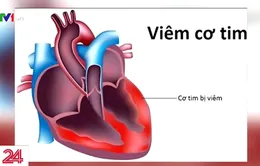 Chưa ghi nhận dịch virus viêm cơ tim