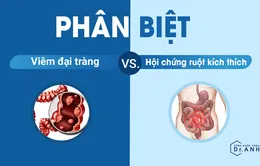 Viêm đại tràng và hội chứng ruột kích thích: Đừng nhầm lẫn nếu chưa hiểu rõ!