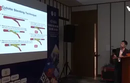Can thiệp mạch - Giải pháp điều trị hiệu quả bệnh tim