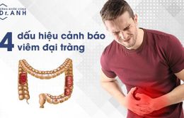 4 biểu hiện hàng đầu báo hiệu bạn đang gặp vấn đề đại tràng