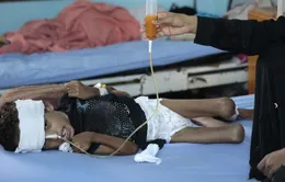 Yemen có thể mất toàn bộ thế hệ trẻ em vì nạn đói