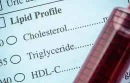 Thuốc giảm Cholesterol dạng viên – lựa chọn mới cho những người sử dụng nhóm thuốc Statin