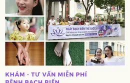 Khám, tư vấn miễn phí bệnh bạch biến tại Hà Nội