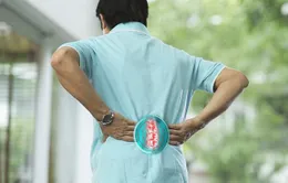 Cách đẩy lùi bệnh đau lưng