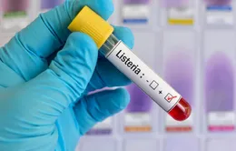 Tây Ban Nha ghi nhận thêm ca tử vong do nhiễm khuẩn Listeria