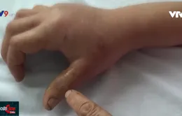 Đề phòng bị rắn tấn công trong mùa mưa