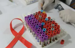 Thế giới có bệnh nhân thứ hai tự khỏi HIV