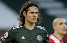 LĐBĐ Anh xác nhận Edinson Cavani có hành vi phân biệt chủng tộc