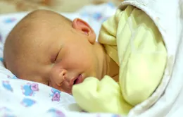 Chẩn đoán bệnh vàng da ở trẻ sơ sinh qua ứng dụng điện thoại