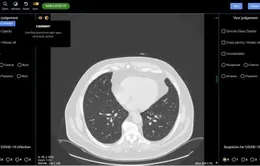 Australia phát triển công cụ AI hỗ trợ phát hiện người mắc COVID-19