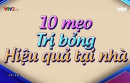 10 mẹo chữa bỏng tại nhà hiệu quả