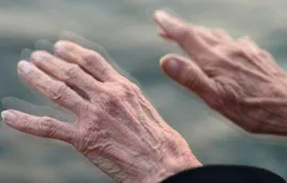 Hy vọng mới cho các bệnh nhân Parkinson