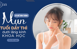 Cơ chế hình thành mụn tuổi dậy thì dưới lăng kính khoa học