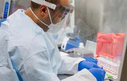 Italy thử nghiệm thành công kháng thể chống virus SARS-CoV-2