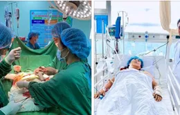 Vỡ gan, vỡ lách, mất hơn 4 lít máu do tai nạn giao thông