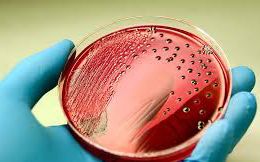 Mỹ điều tra đợt bùng phát các ca nhiễm khuẩn Salmonella Newport