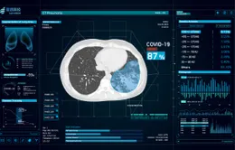 Trung Quốc sử dụng AI để dự báo nguy cơ bệnh nhân COVID-19 trở nặng
