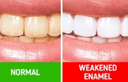 10 bí quyết chăm sóc răng miệng giúp bạn không bao giờ phải gặp nha sĩ
