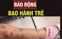 Báo động tình trạng bạo hành trẻ em
