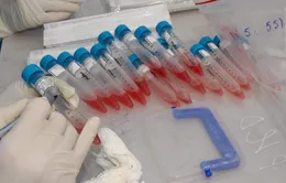 Hà Nội phát hiện 1 ca dương tính với SARS-CoV-2 ở quận Cầu Giấy