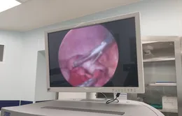 Cảnh báo tình trạng lồng ruột muộn ở trẻ