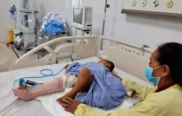Cứu bé trai gần 3 tuổi bị lóc da đùi, lộ xương do tai nạn