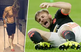 Luke Shaw đã vượt qua chấn thương gãy xương như thế nào?