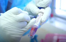5 ca nghi nhiễm COVID-19 ở Thái Bình liên quan BV Bệnh Nhiệt đới Trung ương cơ sở 2