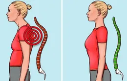 7 bài tập cải thiện tư thế và giảm đau lưng
