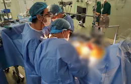 Lần đầu tiên thực hiện bắc 2 cầu động mạch bằng xâm lấn tối thiểu, có nội soi hỗ trợ