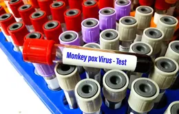 Trường hợp nổi mụn đỏ sau khi trở về từ Nam Phi tại Đắk Lắk âm tính với virus gây bệnh đậu mùa khỉ