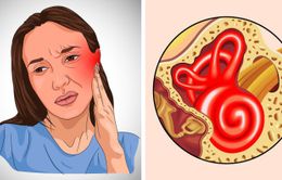 6 dấu hiệu giúp bạn nhận biết đã bị nhiễm trùng tai