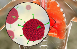 Virus Adeno mà nhiều trẻ đang nhiễm phải nguy hiểm ra sao?