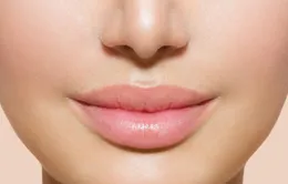 Cải thiện làn môi khô nứt nẻ mà không cần son dưỡng