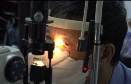Lào Cai ghi nhận hơn 10.500 ca đau mắt đỏ