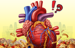 Bạn đã biết gì về nguy cơ tim mạch của mình?