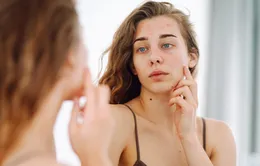 Các cách đối phó với những lo lắng quá mức về da