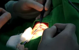 Sở Y tế TP. Hồ Chí Minh thông tin về phản ánh của người bệnh bị giảm thị lực sau phẫu thuật