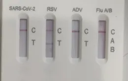 Gia tăng trẻ nhập viện do nhiễm virus hợp bào hô hấp